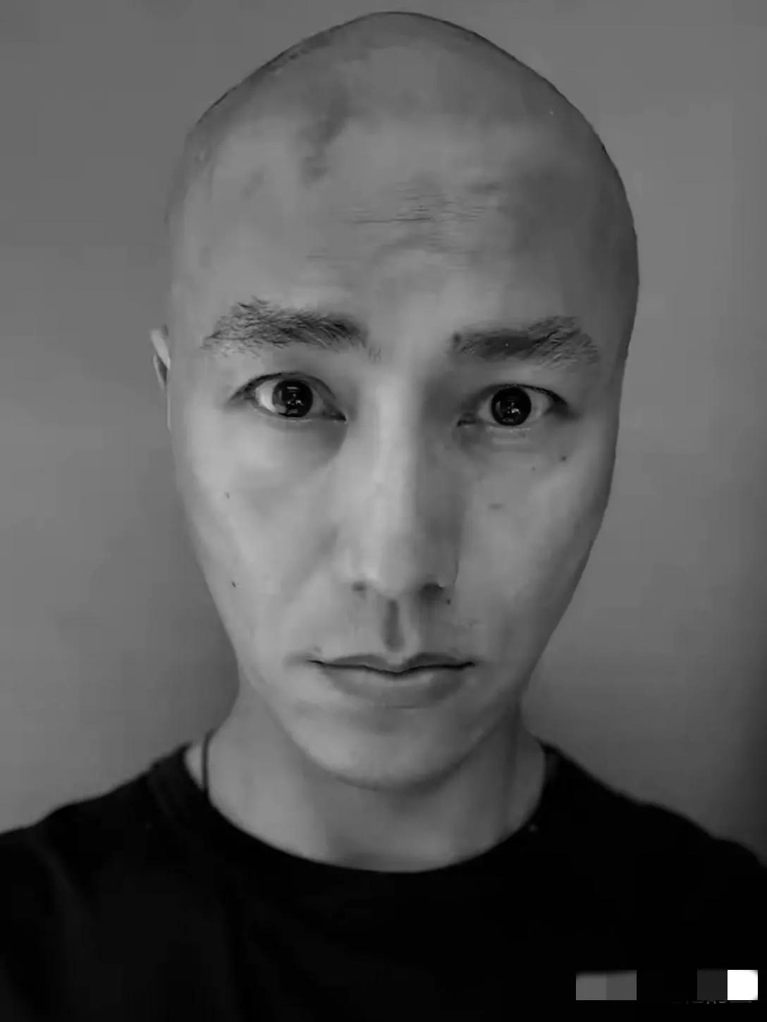 天呐，没有头发的陈坤好吓人呀！头顶冒尖，额纹清晰，脸型狭长，斑点棋布，眼大无神，