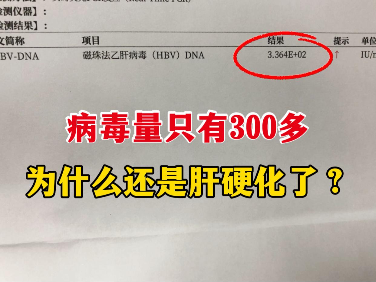 “病毒量只有 300 多，为啥还是肝硬化了？” 今天门诊上，这位患者的...
