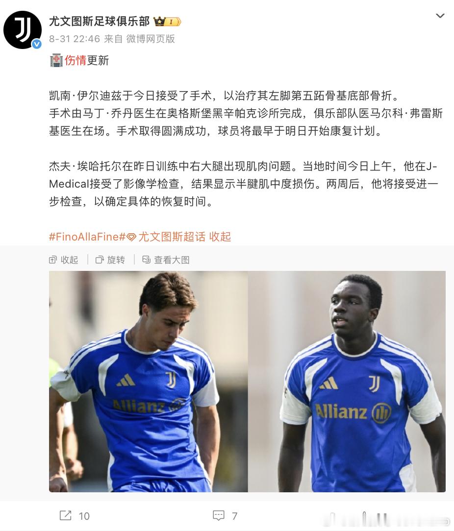 尤文图斯我们正在准备散伙饭过去不到一个月，尤文的伤情通报👇这还没算坎