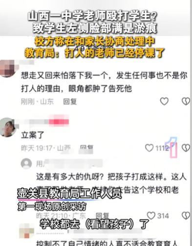 山西长治，家长看到自己的孩子，竟然被老师打，左脸全是淤痕，左眼角都有了淤血，他很