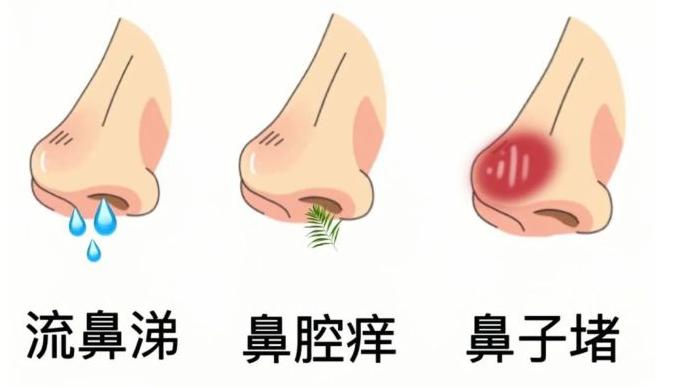 鼻炎，不过是阳气不足了；当阳气补上来，鼻子也就通了。一次，我用一张方子消除患者