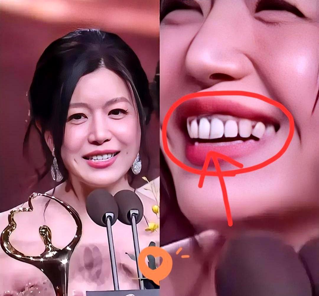 牙龈黑线，毁了多少明星的笑？你以为是牙垢，其实是藏在嘴里的“定时炸弹”。陈妍