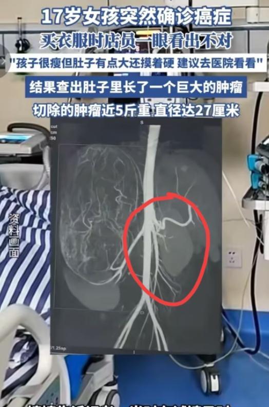 “还好发现及时！”广东17岁女孩和妈妈一起逛街买衣服，在试裤子的时候，老板娘发觉