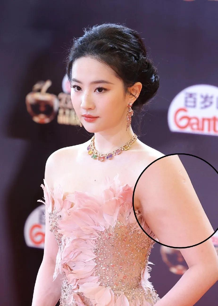 原来仙女也有疤，刘亦菲身上除了牙齿，还有这个疤痕，其他完美！