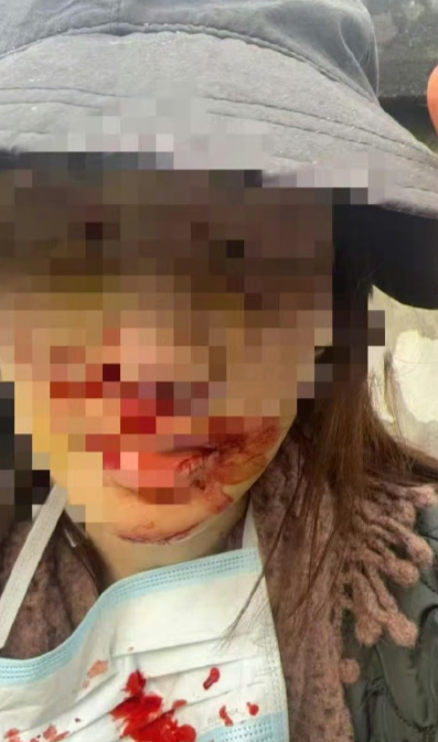 第一：她为了躲小狗自己出事故，最起码很善良的驾驶人。第二：事故造成的车损公共损失