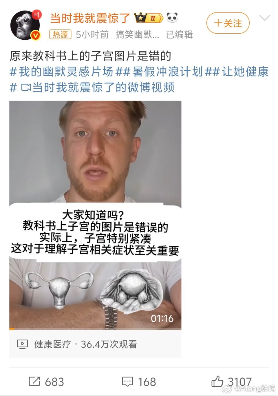 教科书上的子宫图片是错的一直以为就是教科书那样没想到居然是蜷缩在一起的还有什么是