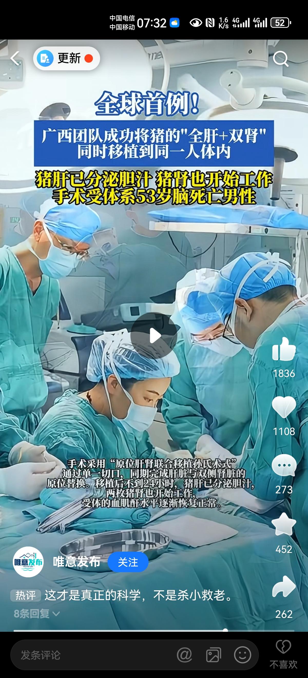 以前看到一段话，那时候是坚决不信，现在有点儿信了。说，“猪和人相似度达到了98