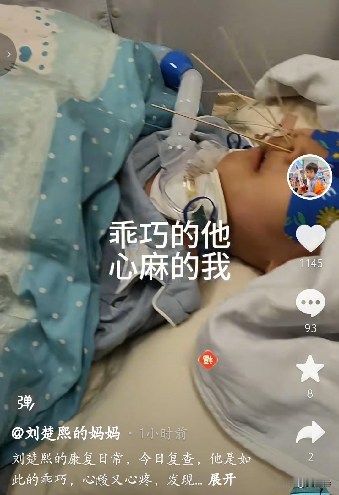 2月24日，刘楚熙的妈妈第一次分享孩子的治疗过程，配文说：“他是如此的乖巧，心酸