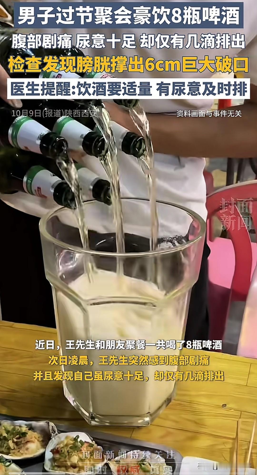 震惊！男子过节聚会豪饮8瓶啤酒腹部剧痛个，尿意十足，却仅有几滴排出，结果
