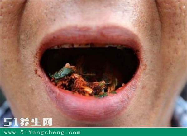 医生提醒: 爱吃这3类食物等于吃毒药, 你还敢随便吃吗?