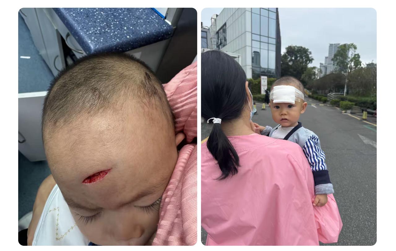 家长们一定要看好孩子啊，这磕碰一下心都碎了