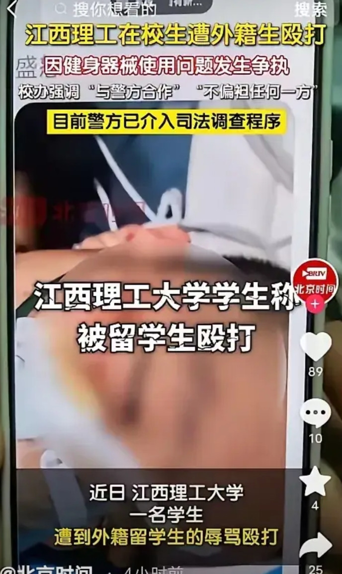 江西某大学发生校内学生冲突，一本国男生被外国三男生围殴，造成本国男生眼部受伤，据