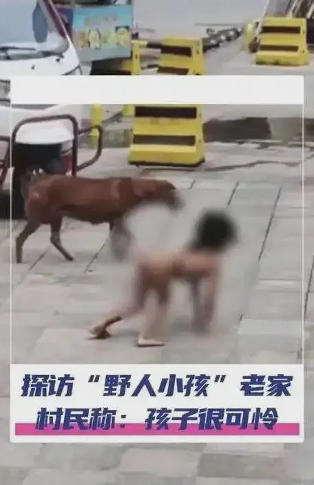 野人孩子已出现动物化特征这两天刷到新闻感觉很难受😣“人为犬化”这个词真的