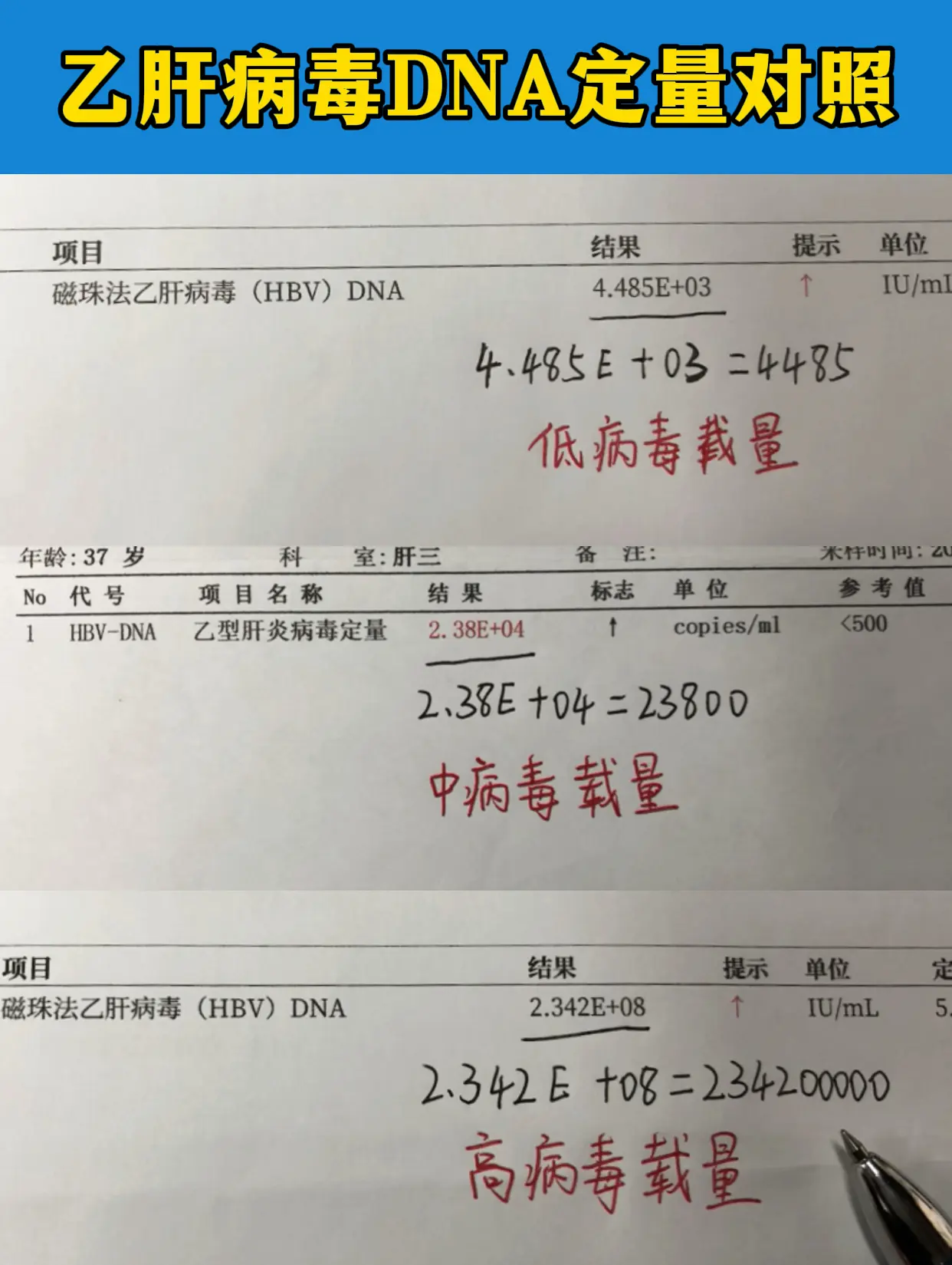 很多朋友看不懂检查单，今天我来教会你如何看懂乙肝病毒量！ 大家看“+”...