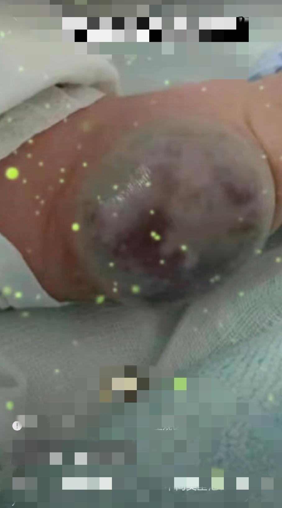 都说“体内有癌，睡眠先知”，这还真不是危言耸听。就像李先生，56岁一直觉得身体还