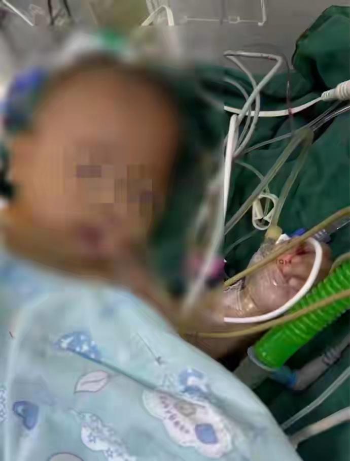五个月大的女婴小洛熙，做完手术之后离世了，尸检结果曝光！女婴死亡真相竟与网络传言