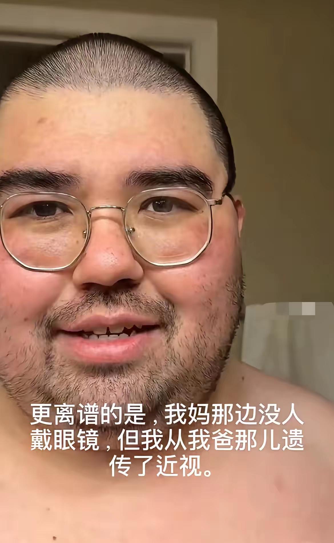 混血吐槽自己遗传了妈妈的身高和爸爸的近视，肥胖。眼睛。哈哈说实话，混血都很漂