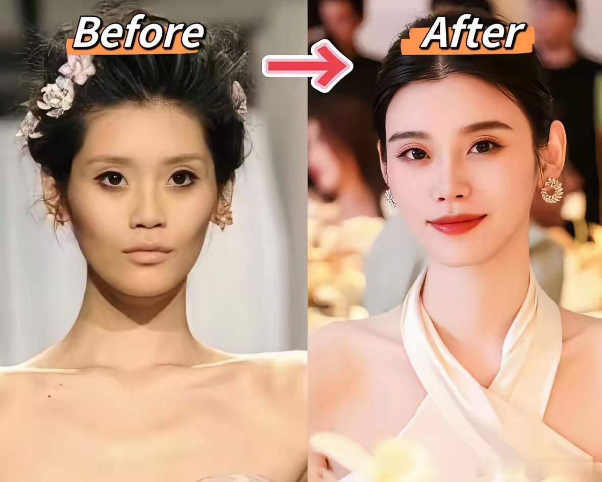 不得不承认，有钱人的医美和普通人的医美，完全不在一个审美上。看看奚梦瑶，从前的脸