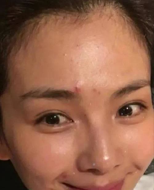 我男朋友说刘涛真丑，我仔细看了一下，妈呀是真的丑啊，听说她以前牙齿不好看牙齿全部