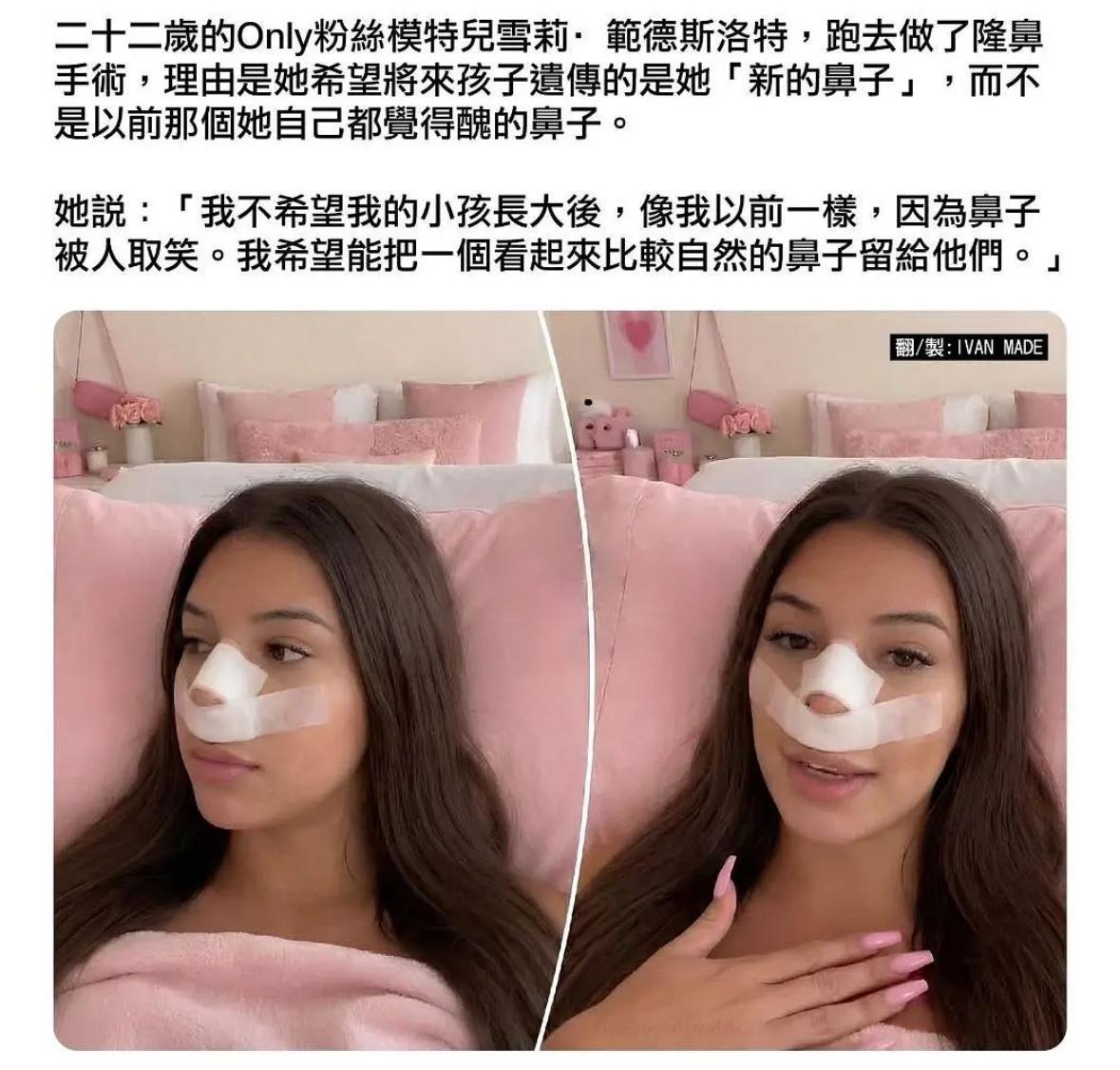 看这个发言，可能遗传给孩子最糟糕的还不是那个她不喜欢的鼻子