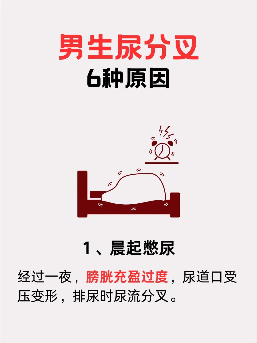 尿分叉别太担心，不一定是生病了