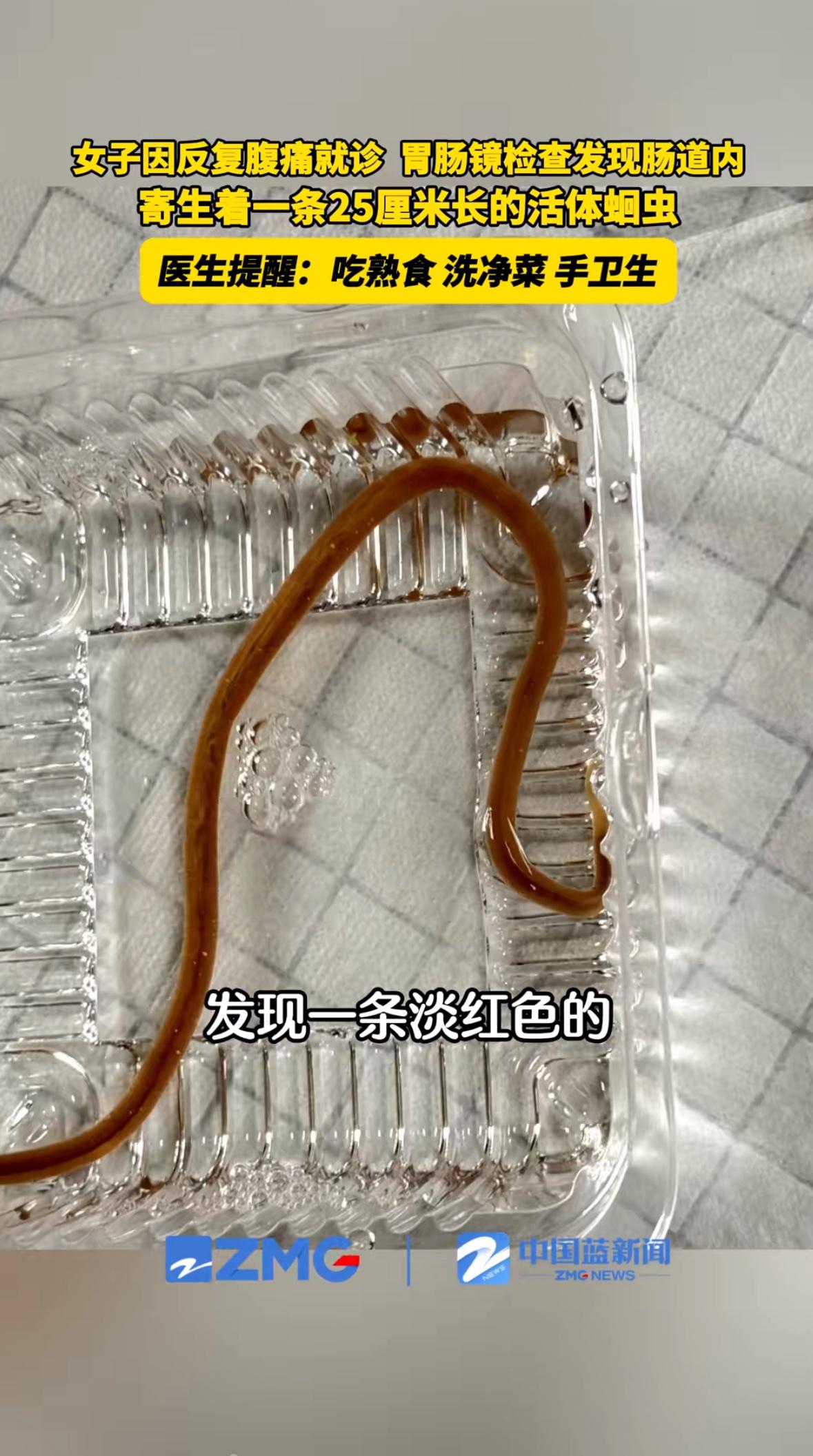 “20厘米长的活虫在肚子里扭动——这哪是腹痛，分明是身体在敲警钟！”最近，湖北十