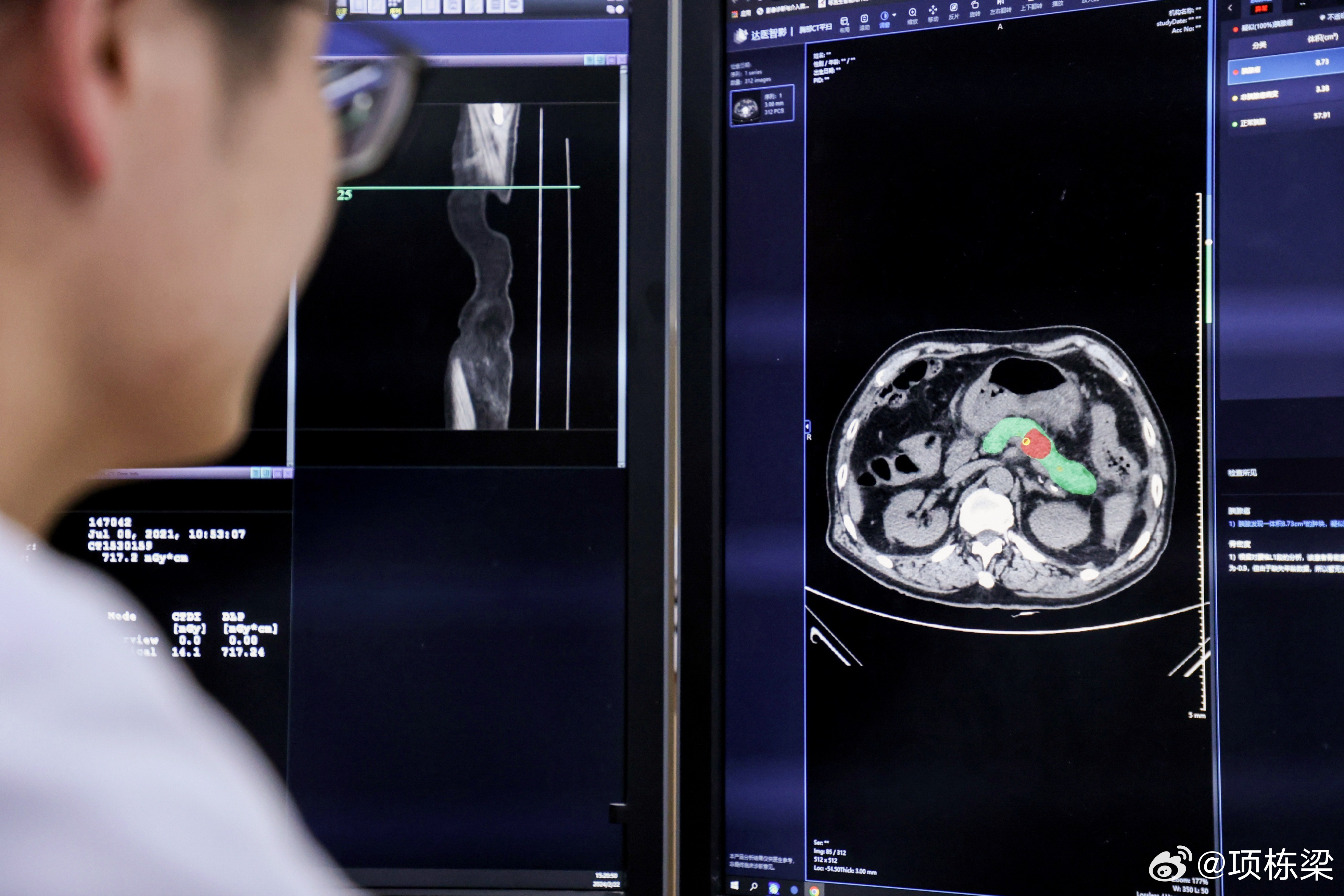 还在争论谁家AI好用？阿里已经在NextLevel悄然行动比AI“好