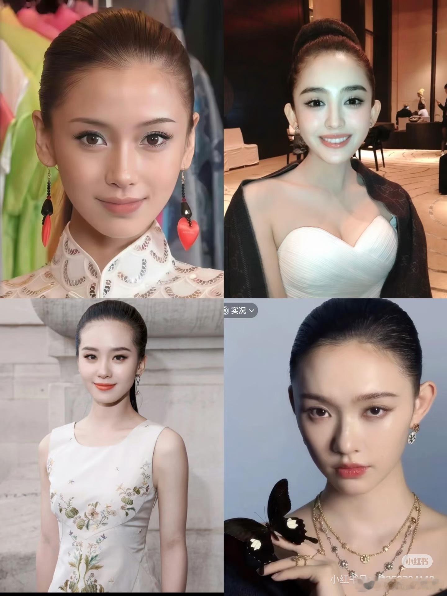 其实田曦薇额头并不算大，只是前颅顶保不住额头，额头的高光点又很奇怪的在最上面而不