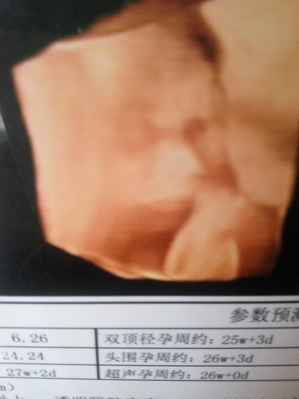 当我第一次看见孩子“四维彩超”的那一刻