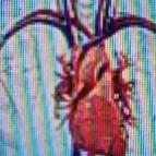 人老了心慌气短，很可能是缺了气血。随着年龄增长，身体机能下降，气血的生成和运行都