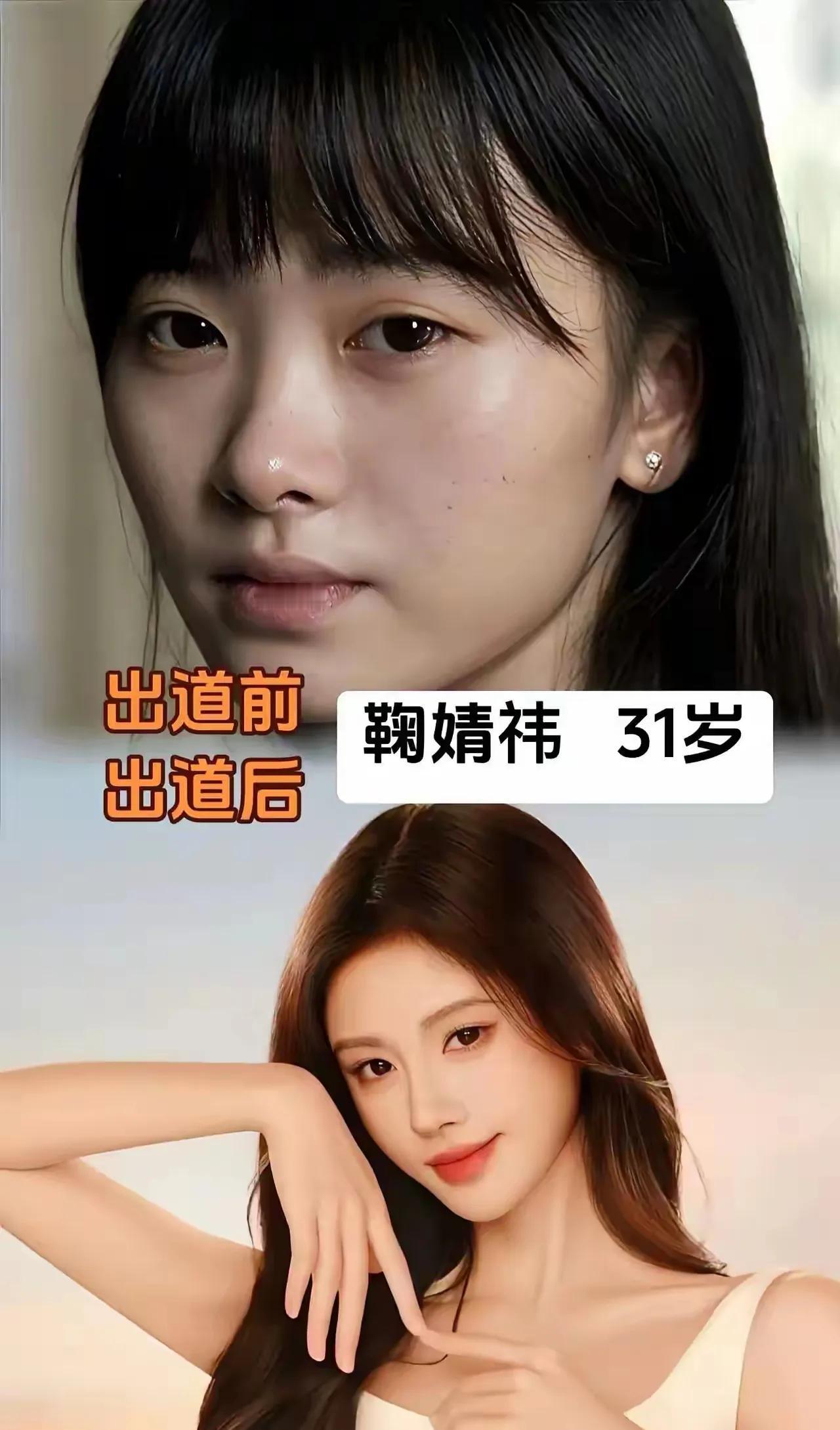 近段时间，鞠婧祎因为和经纪公司的纠纷频上热搜，现在看看她出道前跟出道后的照片，你