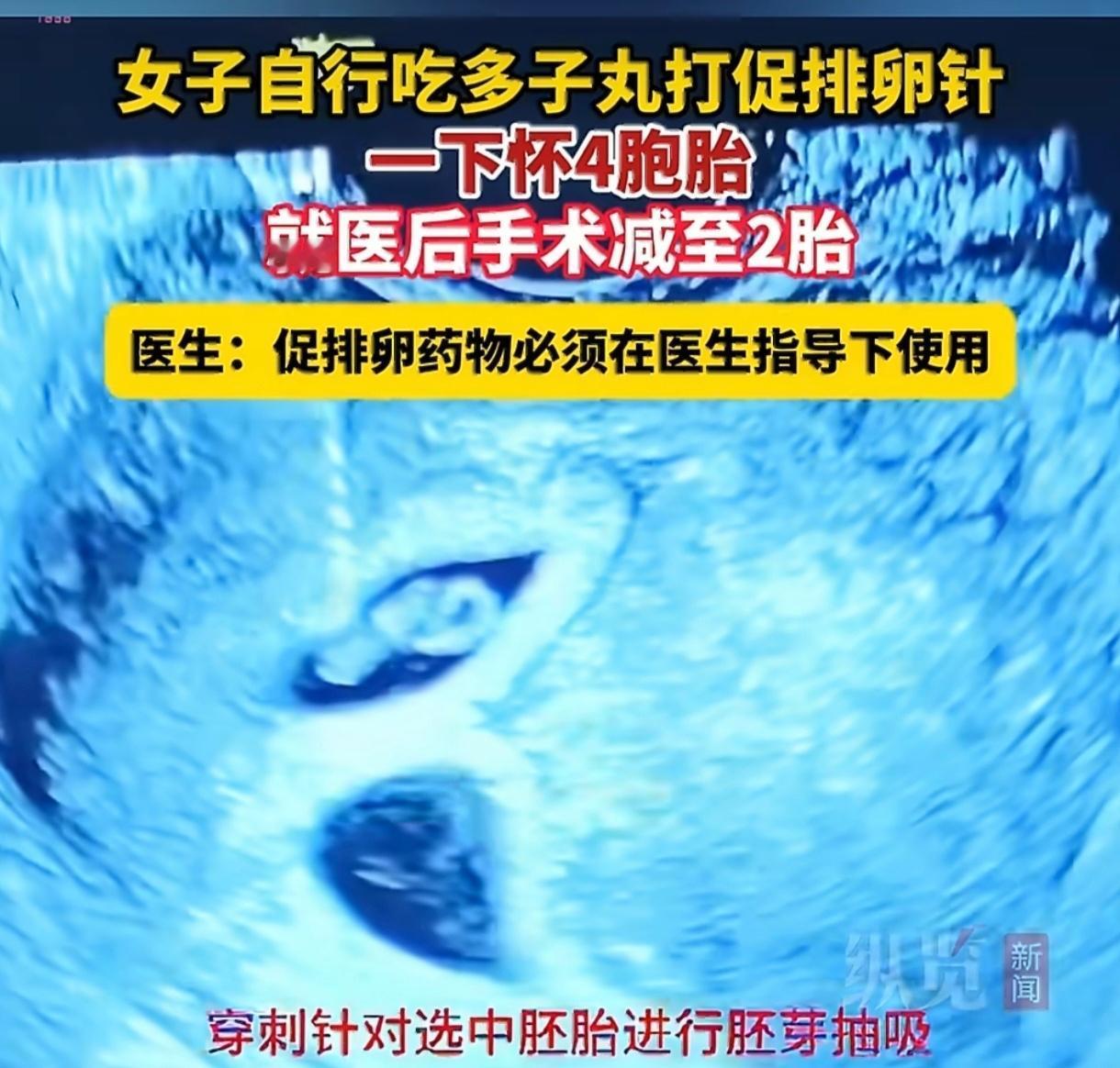 有位备孕许久一直没好消息的女士，心里着急又焦虑，不想再慢慢等医生调理，就自己去药