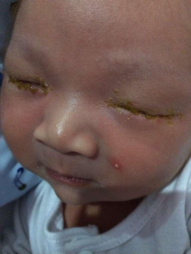 宝宝都满月了为什么还不睁眼? 妈妈自以为是这样做, 差点毁了宝宝的一生