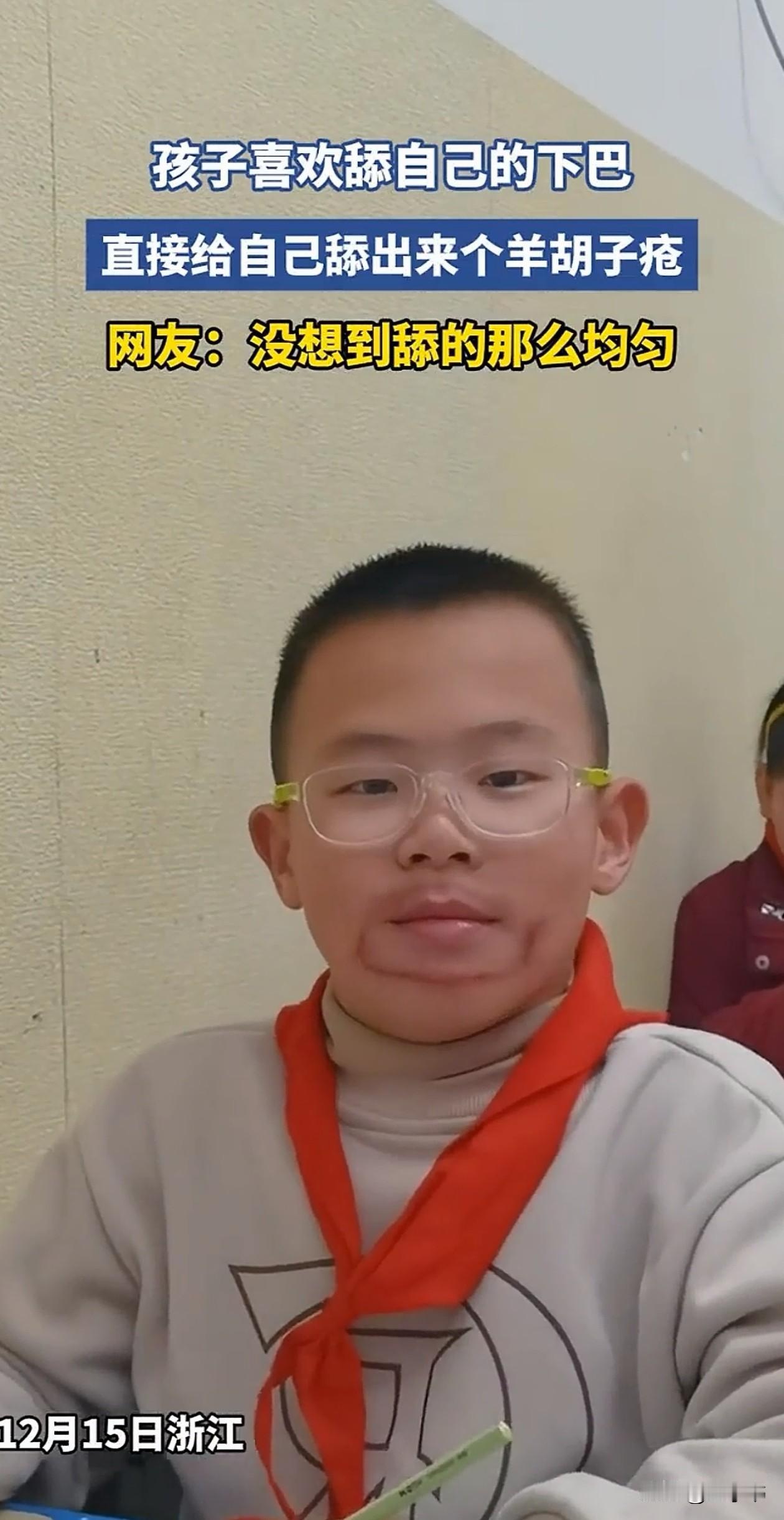 浙江，小男孩有个小习惯，老喜欢用自己的舌头去舔下巴，这么天天舔、天天舔，硬生生给