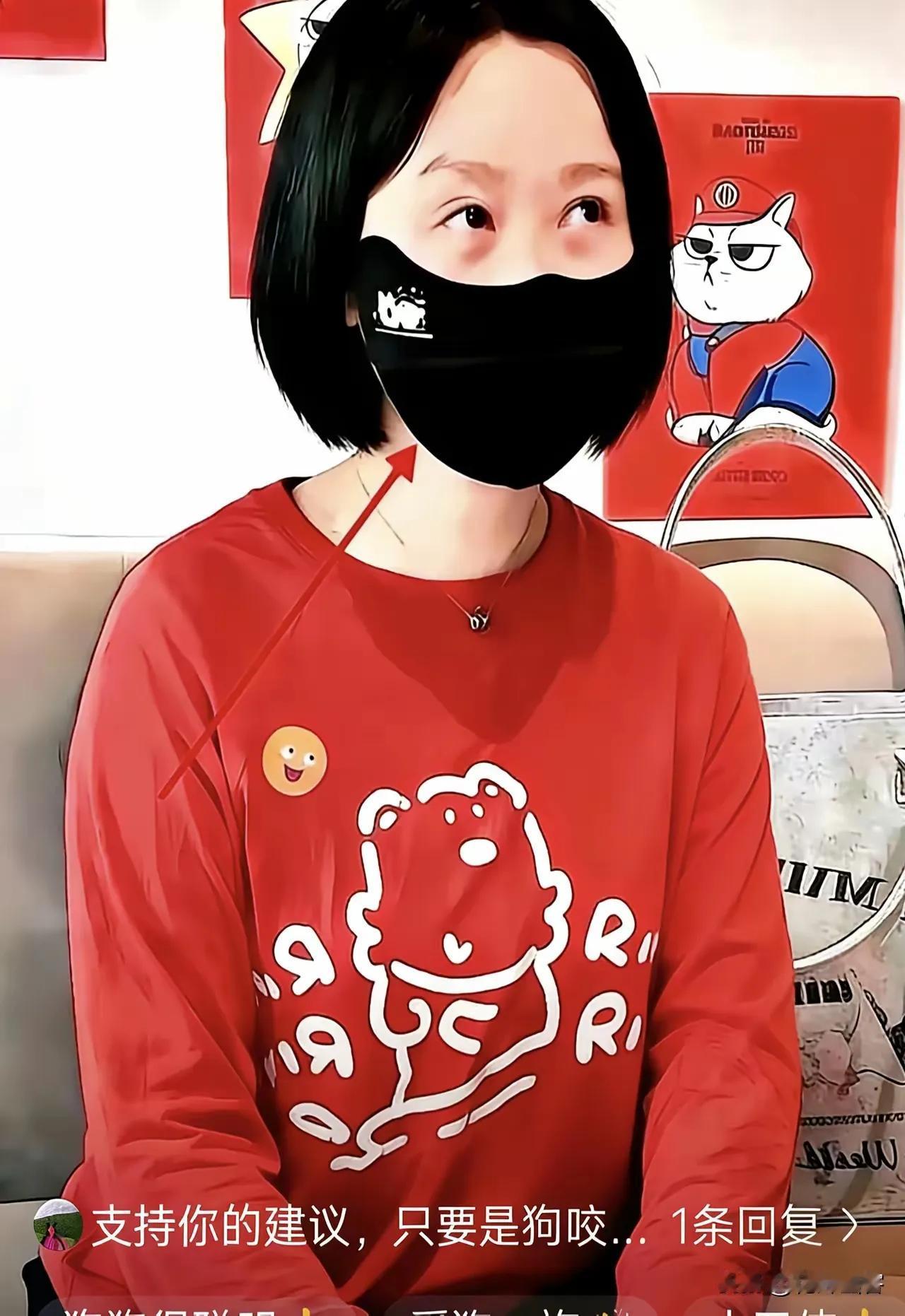 狗咬人主人负刑责，起步就是一年有期徒刑，别谈钱，直接谈自由！这招简直戳中了要害。