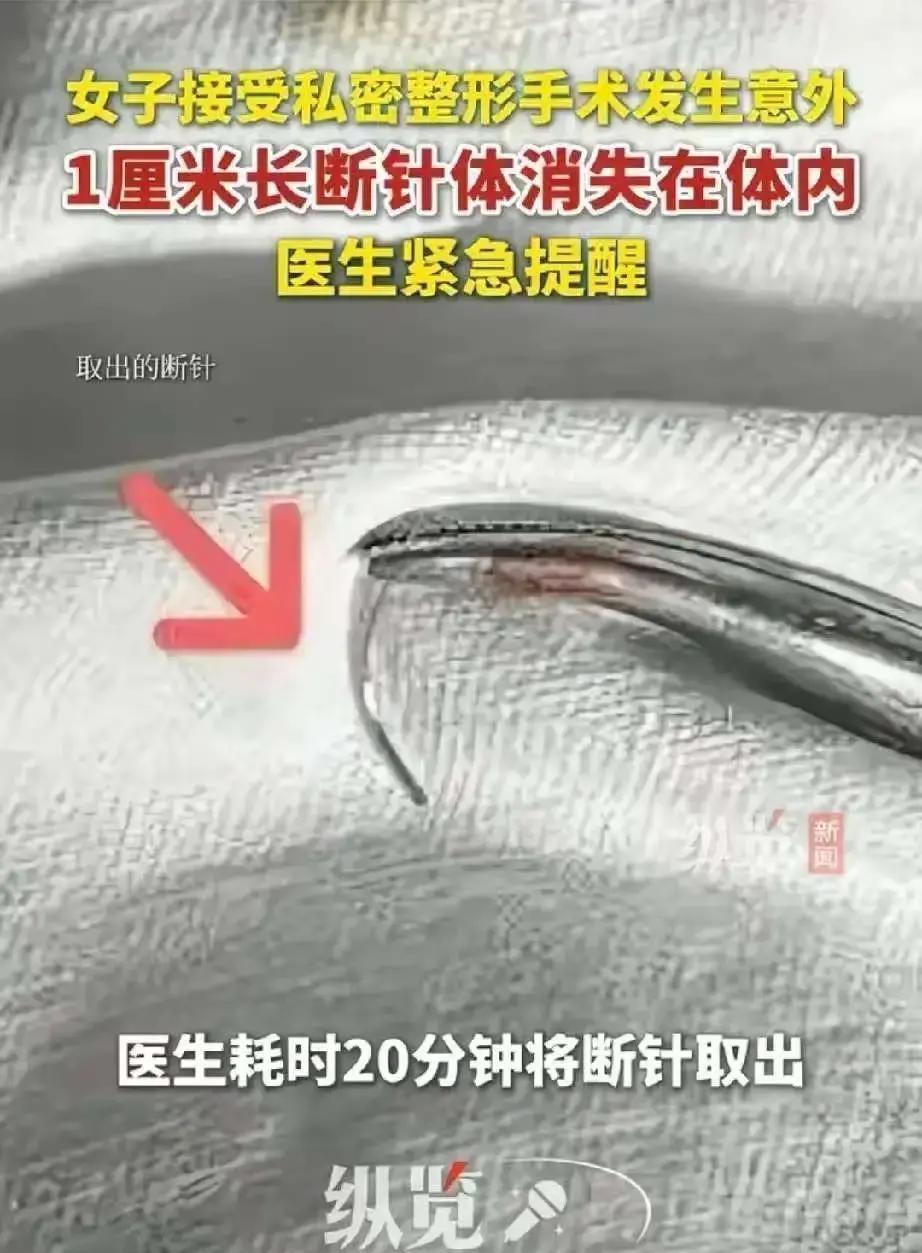 “好悬！”浙江，一女子产后，为了夫妻生活质量不受影响，去美容机构做下体紧缩术，可
