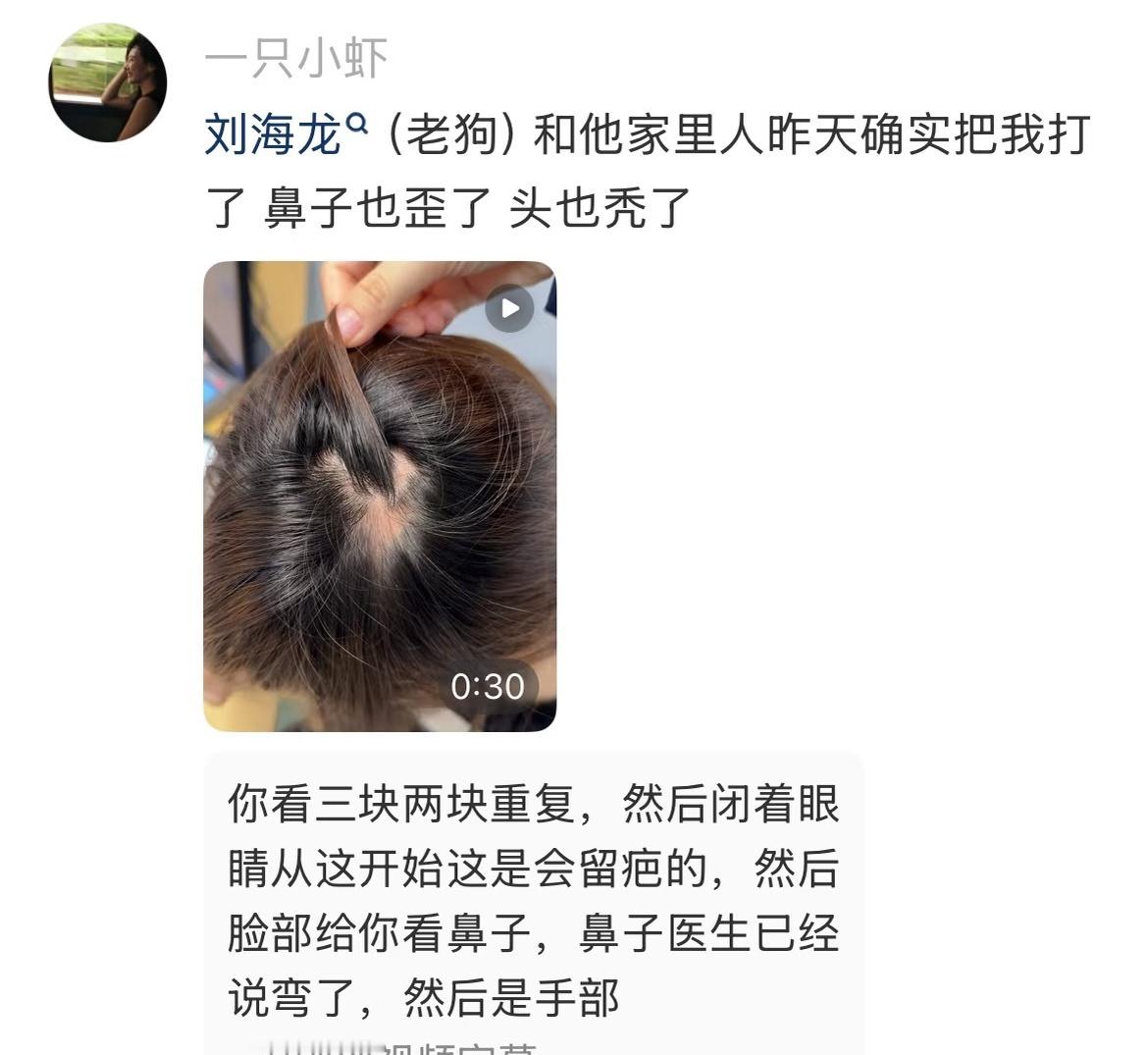 韩安冉赔偿助理10万元伤成这样才赔10万块钱吗，韩安冉什么时候这么小方了。