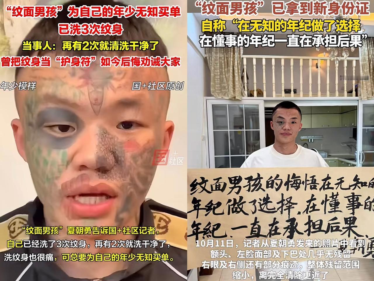 “后悔了吧？”06年出生的广东男孩夏朝勇，正硬扛着第五次激光洗纹身的剧痛。