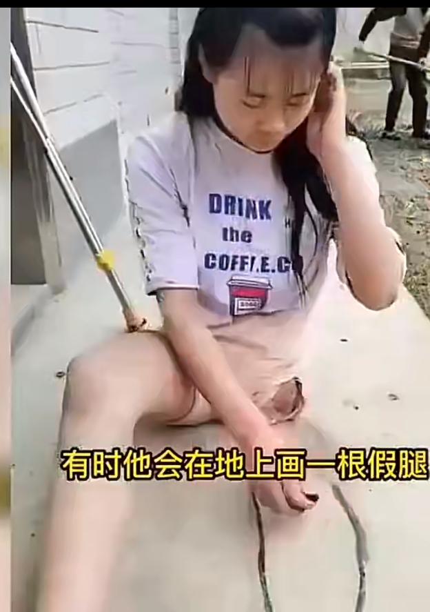 刷视频看到这个乐观的贵州独腿女孩，今年20岁，名叫韦宝，和奶奶相依为命。爸妈吵架