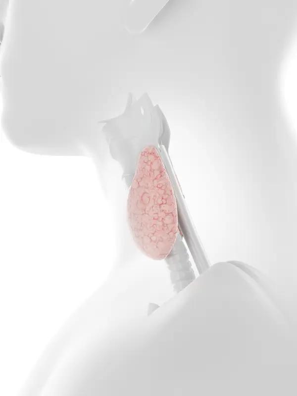 甲状腺乳头状癌淋巴结转移后是有可能复发的。我有个朋友，之前患了甲状腺乳头状癌，还