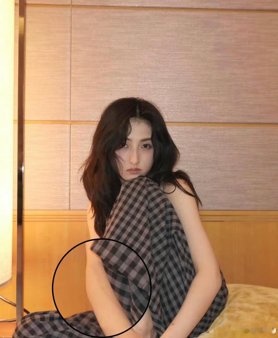 张子枫手臂都是伤疤看到张子枫手臂的伤疤真的狠狠心疼了💔以前拍那么多动作戏都没受
