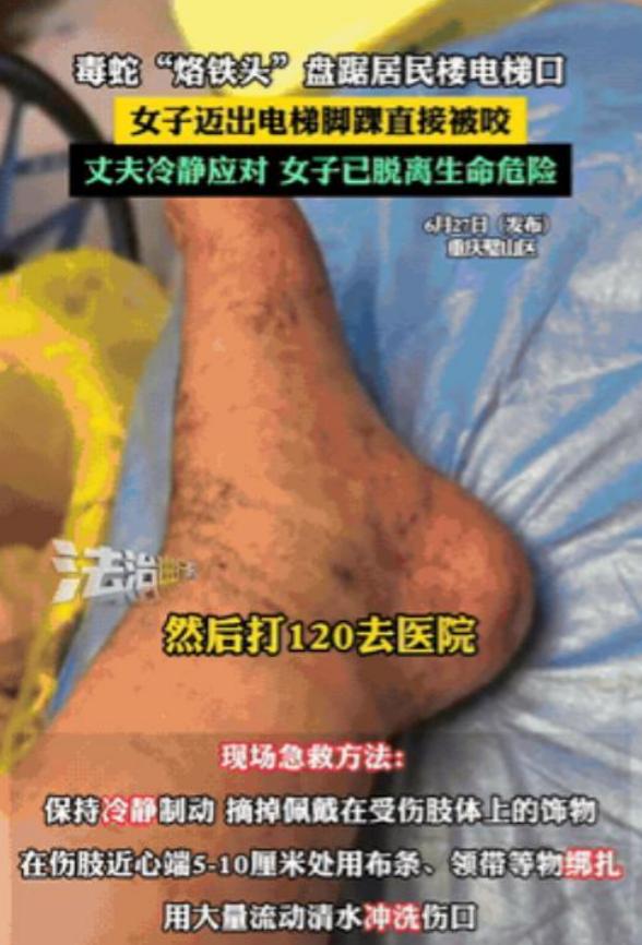 悲剧还是发生了！”重庆，一女子在小区电梯口遭遇毒蛇袭击，脚部迅速肿胀！6