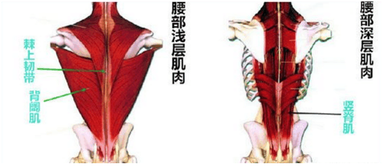 “腰肌劳损”和“腰椎间盘突出”的区别