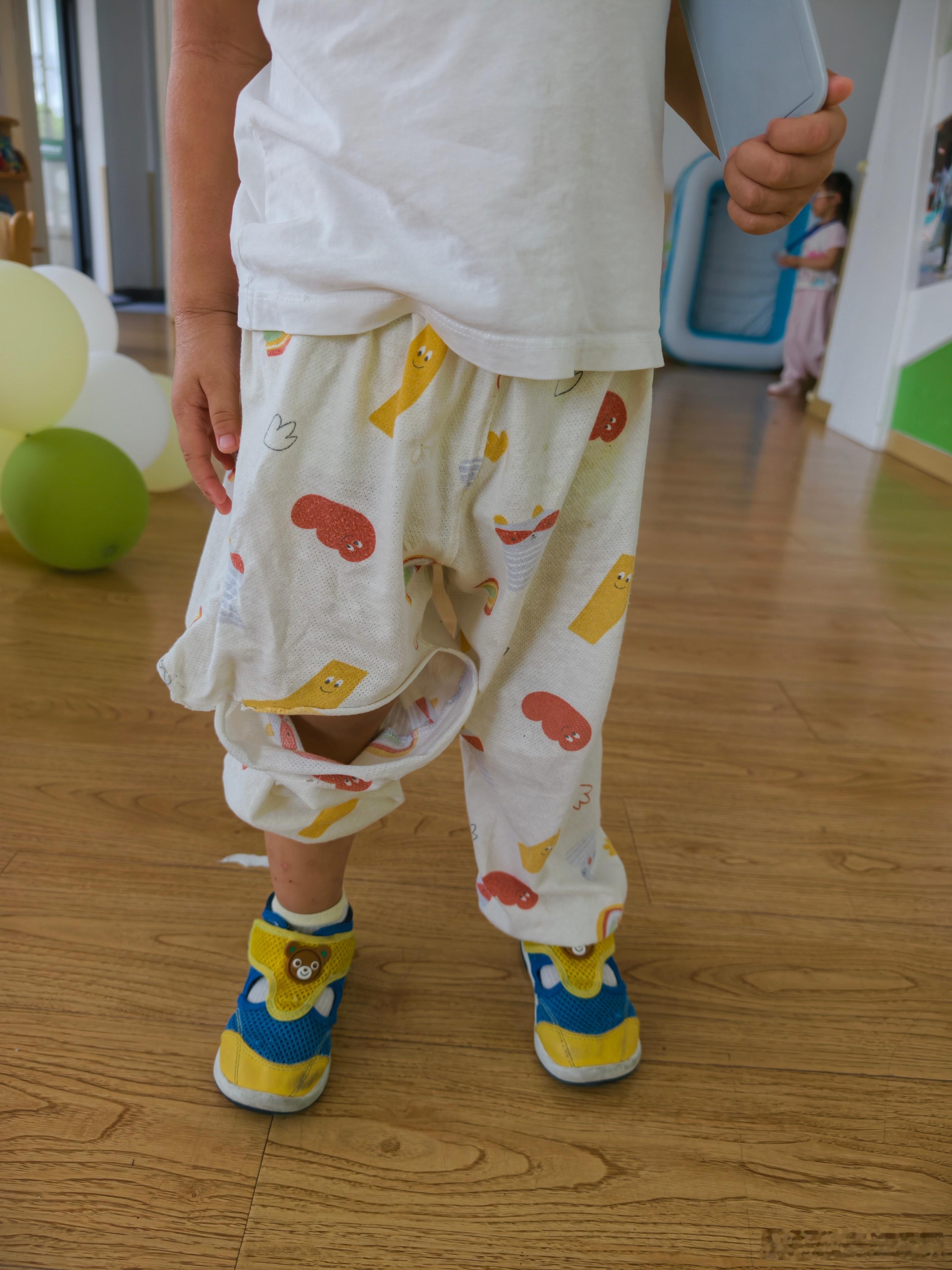 他跟我说这裤子不听话自己要张开嘴巴[捂脸哭]，幼儿园才上半天……​​​