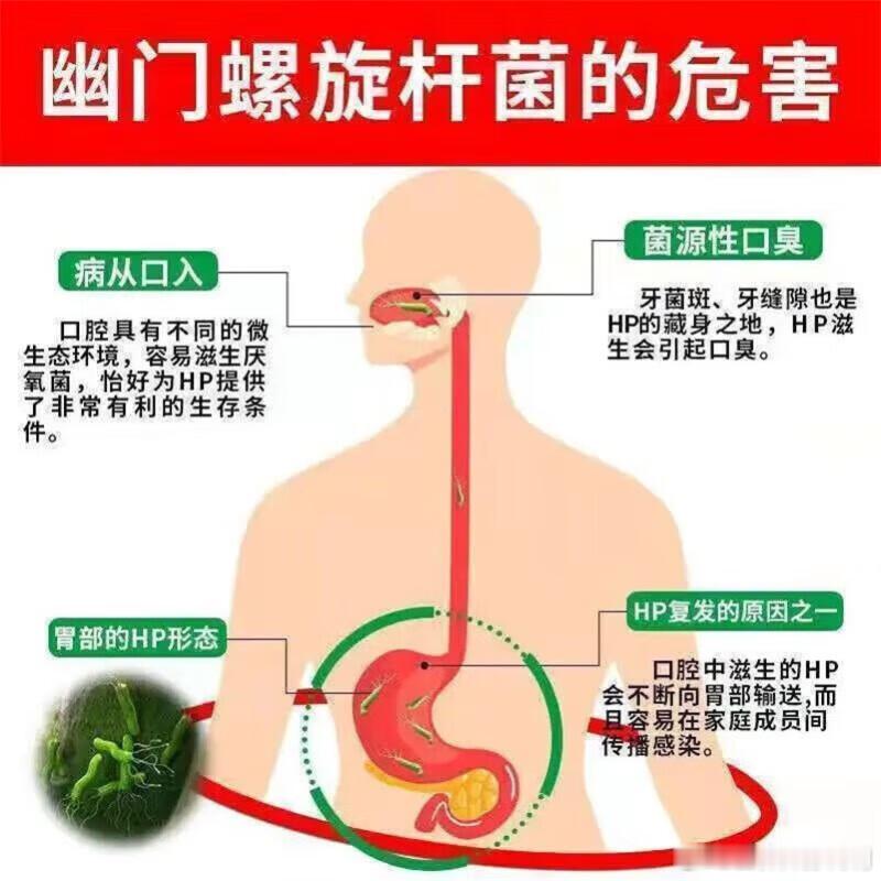 把健康带回家全民慢病健康科普计划健闻登顶计划【5个坏习惯让胃酸反流】5、幽门螺