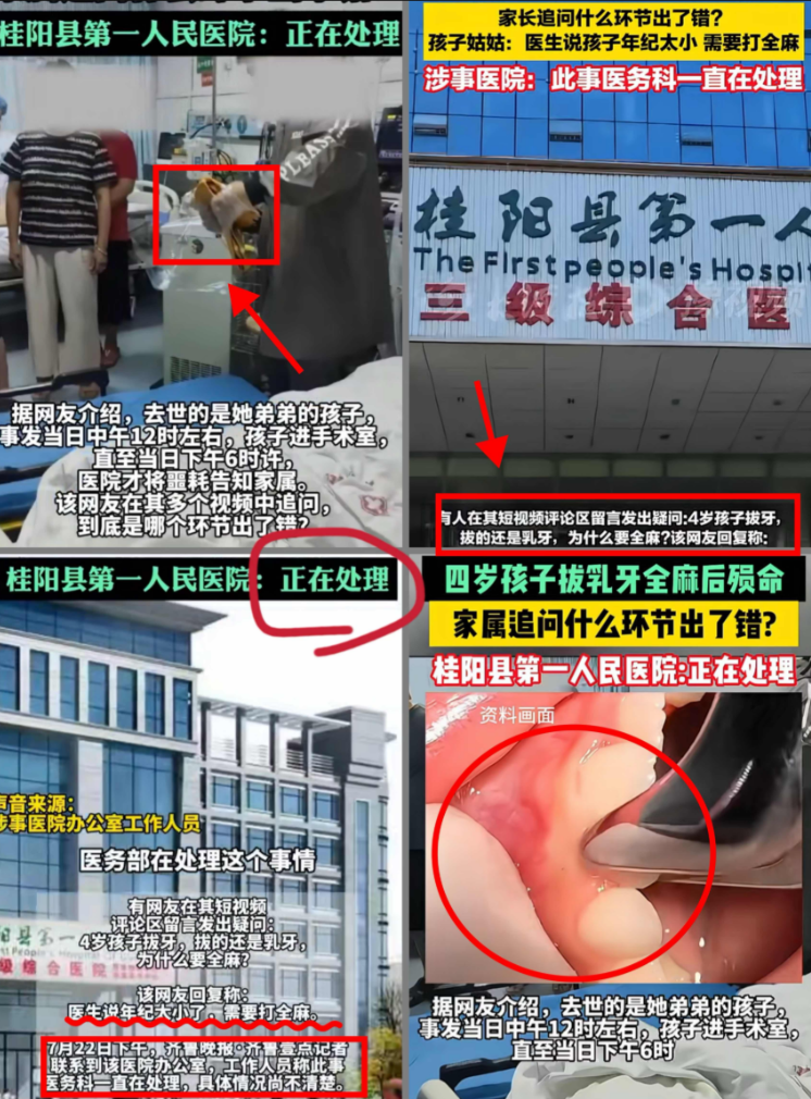 我实在想不明白，不就是拔个牙吗，为什么还要全麻？
