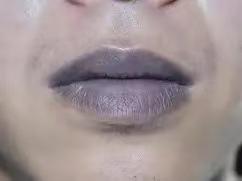脾胃有病，嘴巴先知！从嘴唇颜色，读懂脾胃健康信号！1.嘴唇黑紫如果你的