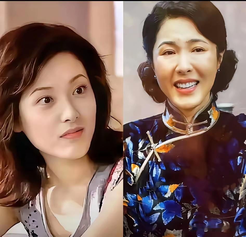 可怕的医美，毁了一个又一个，当医美让人变得笑起来比哭还难看，脸肿得像发面馒头