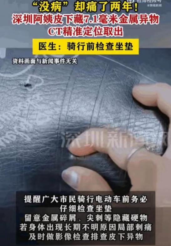 “终于找到了！”深圳62岁阿姨被针扎般疼痛折磨2年，常规检查一直没发现异常，CT