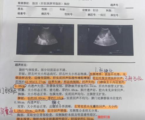 一分钟教你科学解读肝脏超声报告！1、低回声，一般恶性概率较大。2、无回声，大